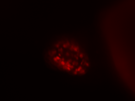 Detail Live-Cell Image der Lokalisation des Myl7:nucDS-RED Konstrukts im Zebrafischherz