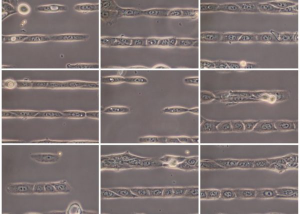 cell micropatterning square HaCaTB10 keratin 5 phalloidin integrin beta4